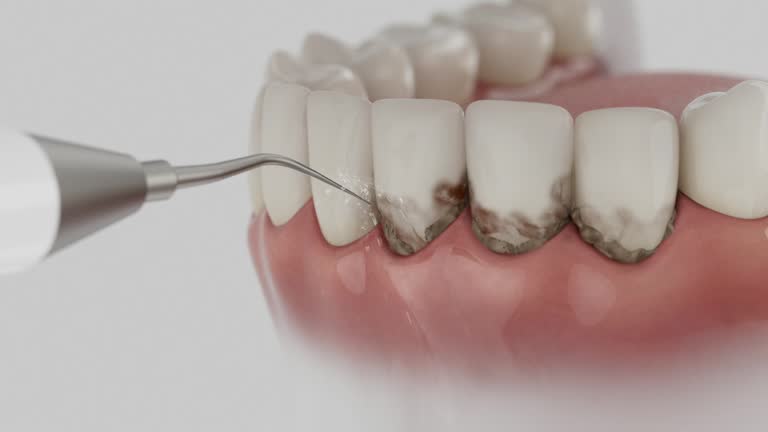 Reliable Dental Implants contractor in Blue Mountain, MS by Smile Center Dentistry
